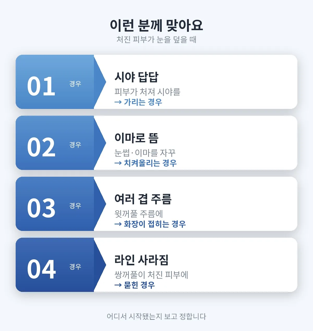 상안검 관련 이미지