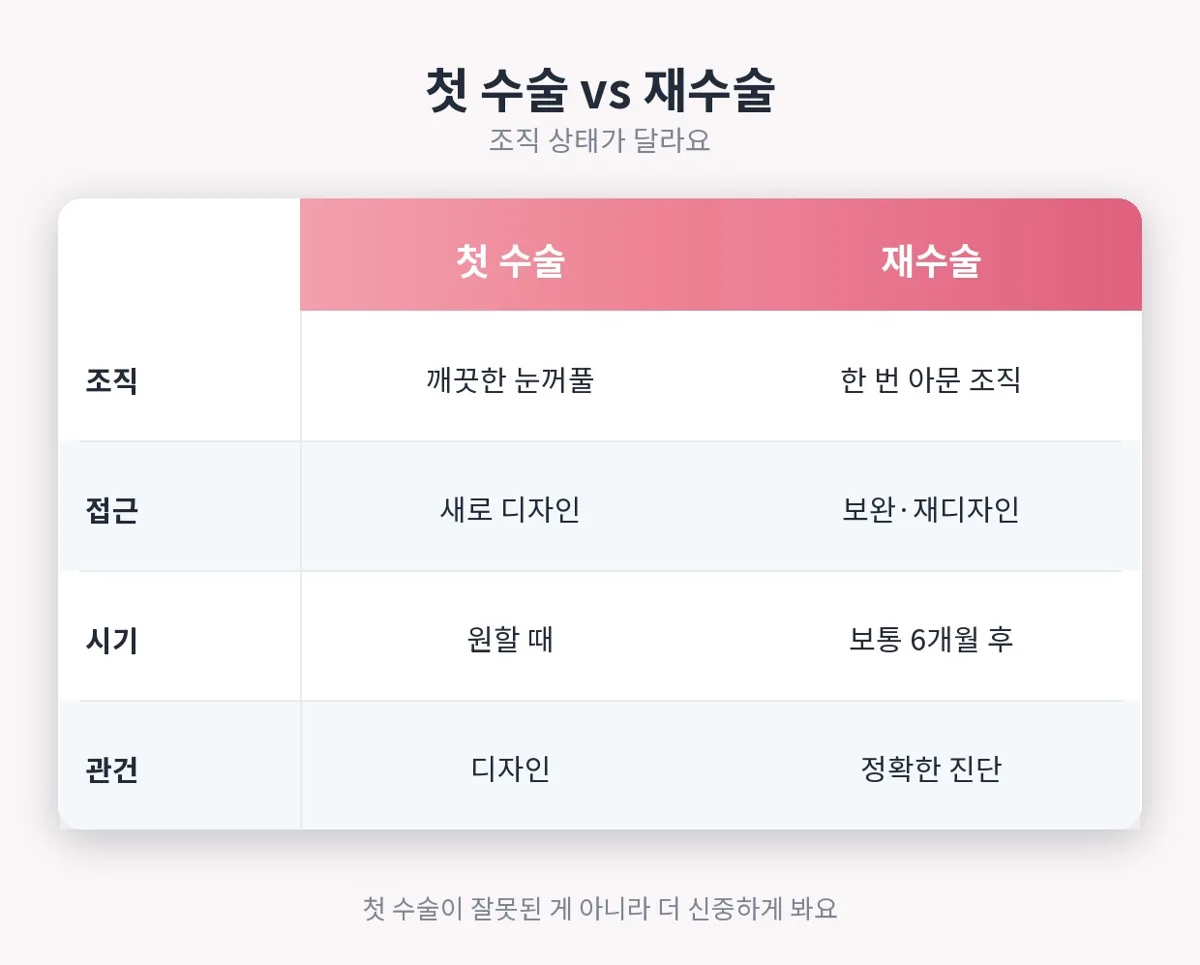 쌍꺼풀재수술 관련 이미지
