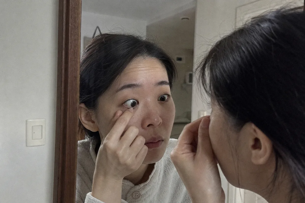 앞트임복원 관련 이미지