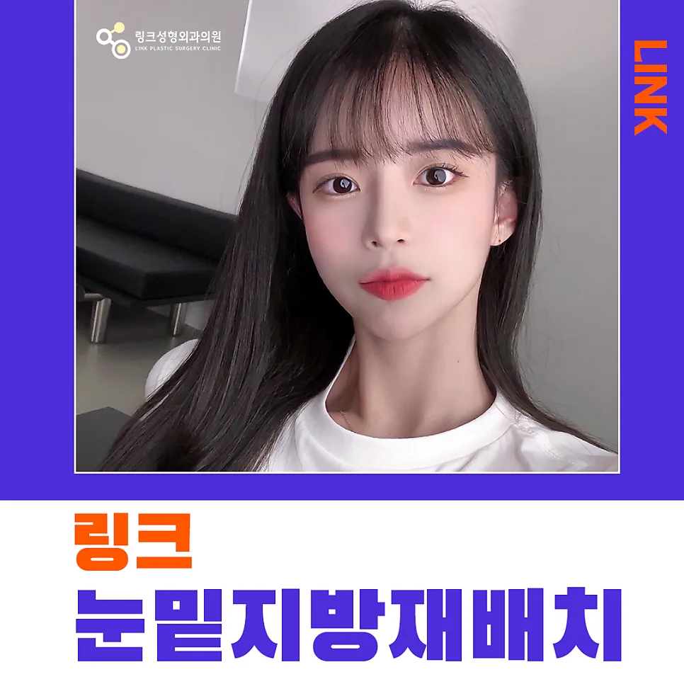 눈밑지방재배치 관련 이미지