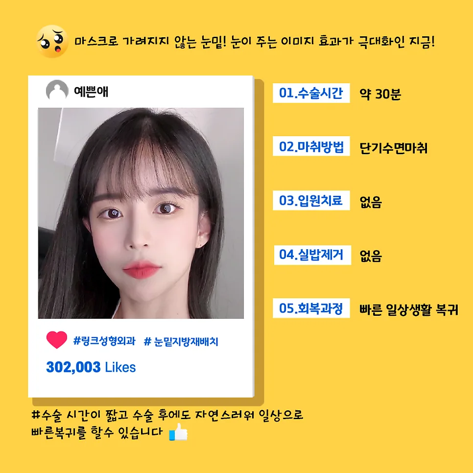 눈밑지방재배치 관련 이미지