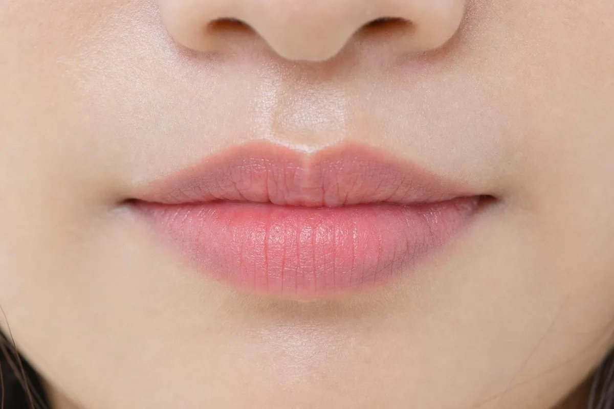 입술필러 관련 이미지
