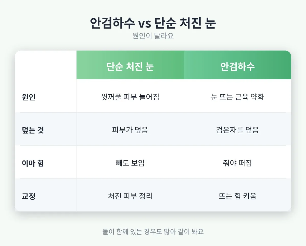 안검하수 관련 이미지