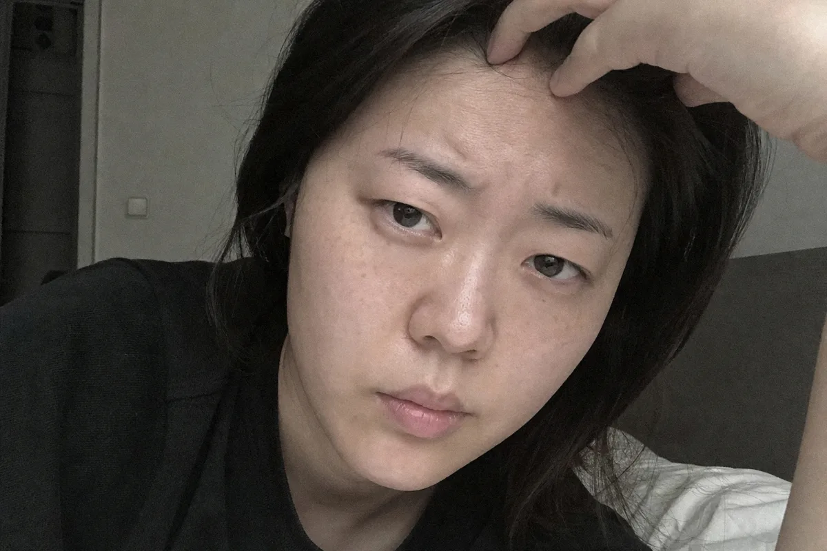 안검하수 관련 이미지