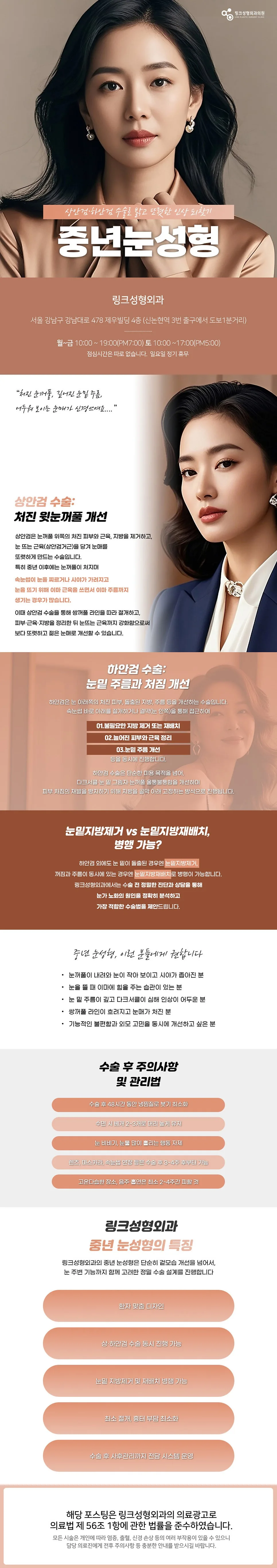 상안검 관련 이미지