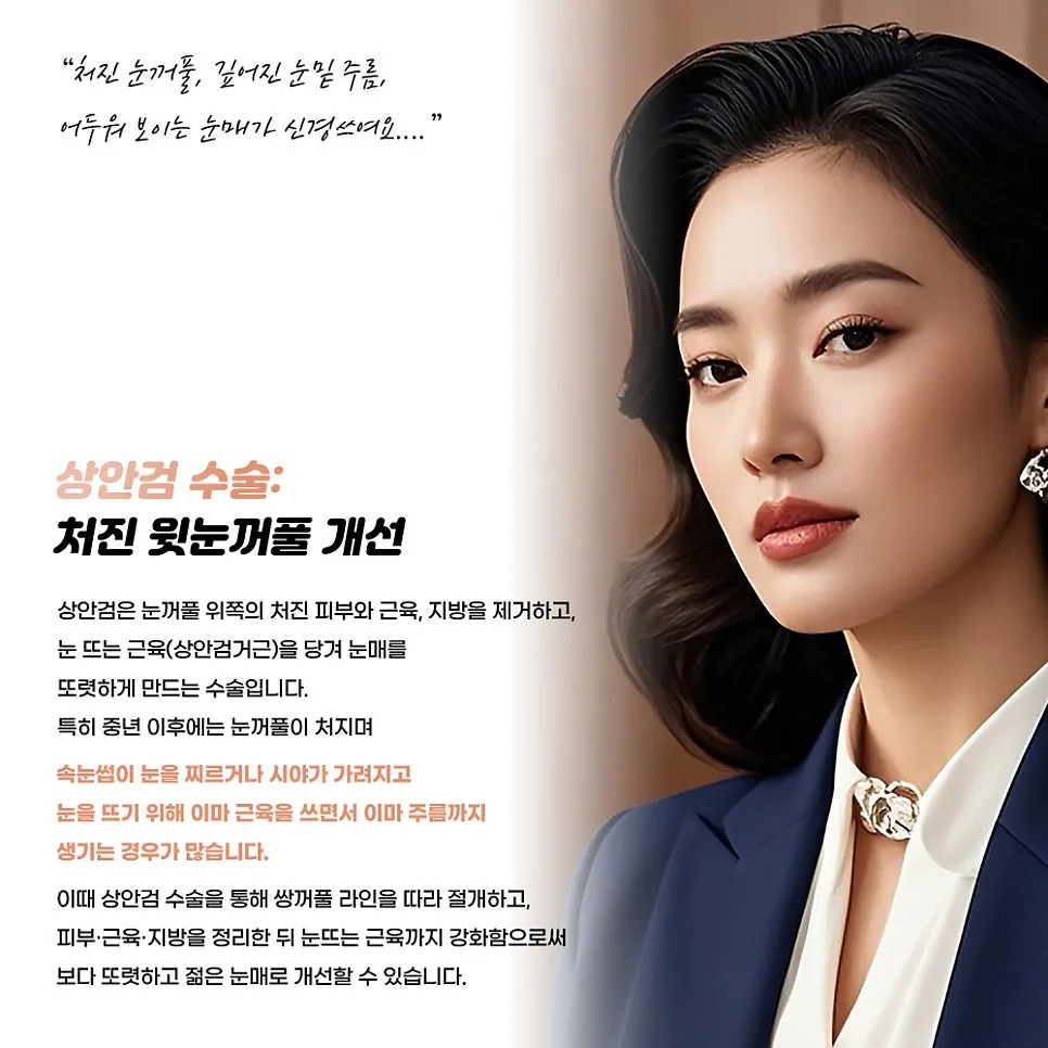 상안검 관련 이미지