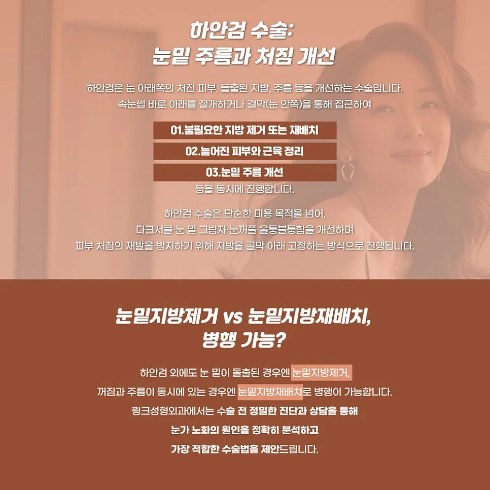 상안검 관련 이미지