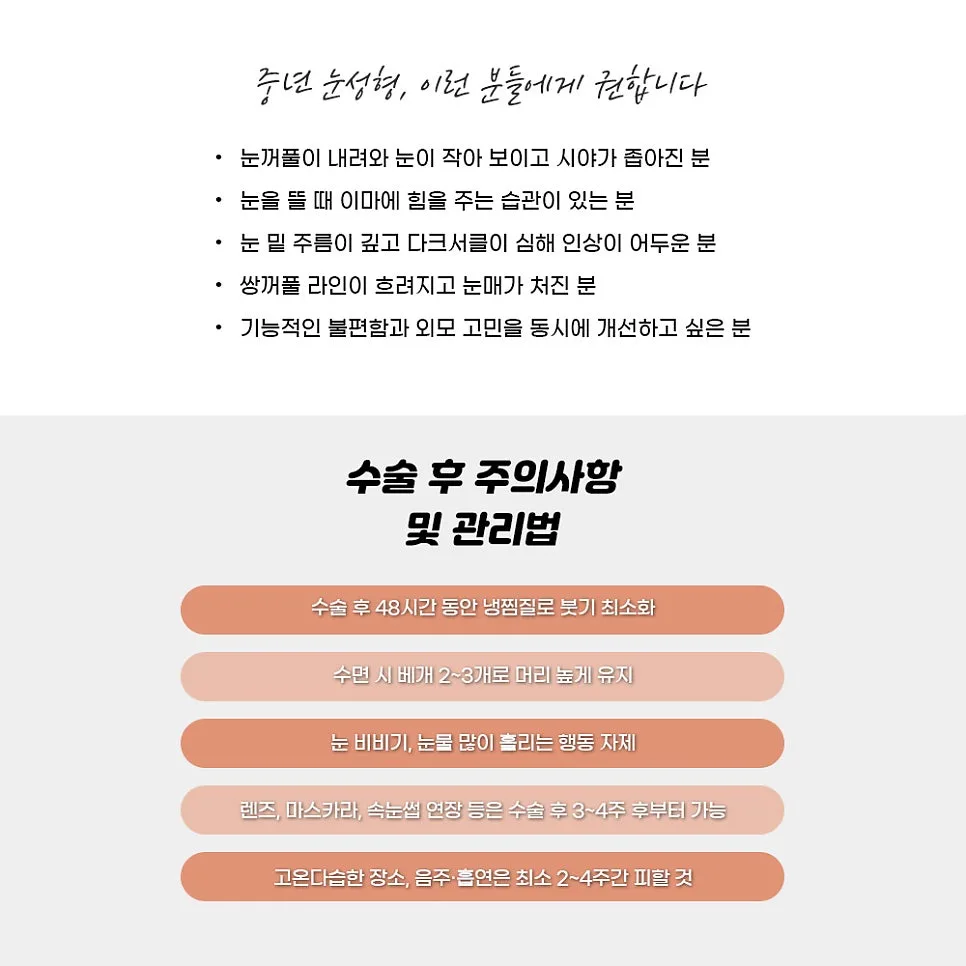 상안검 관련 이미지