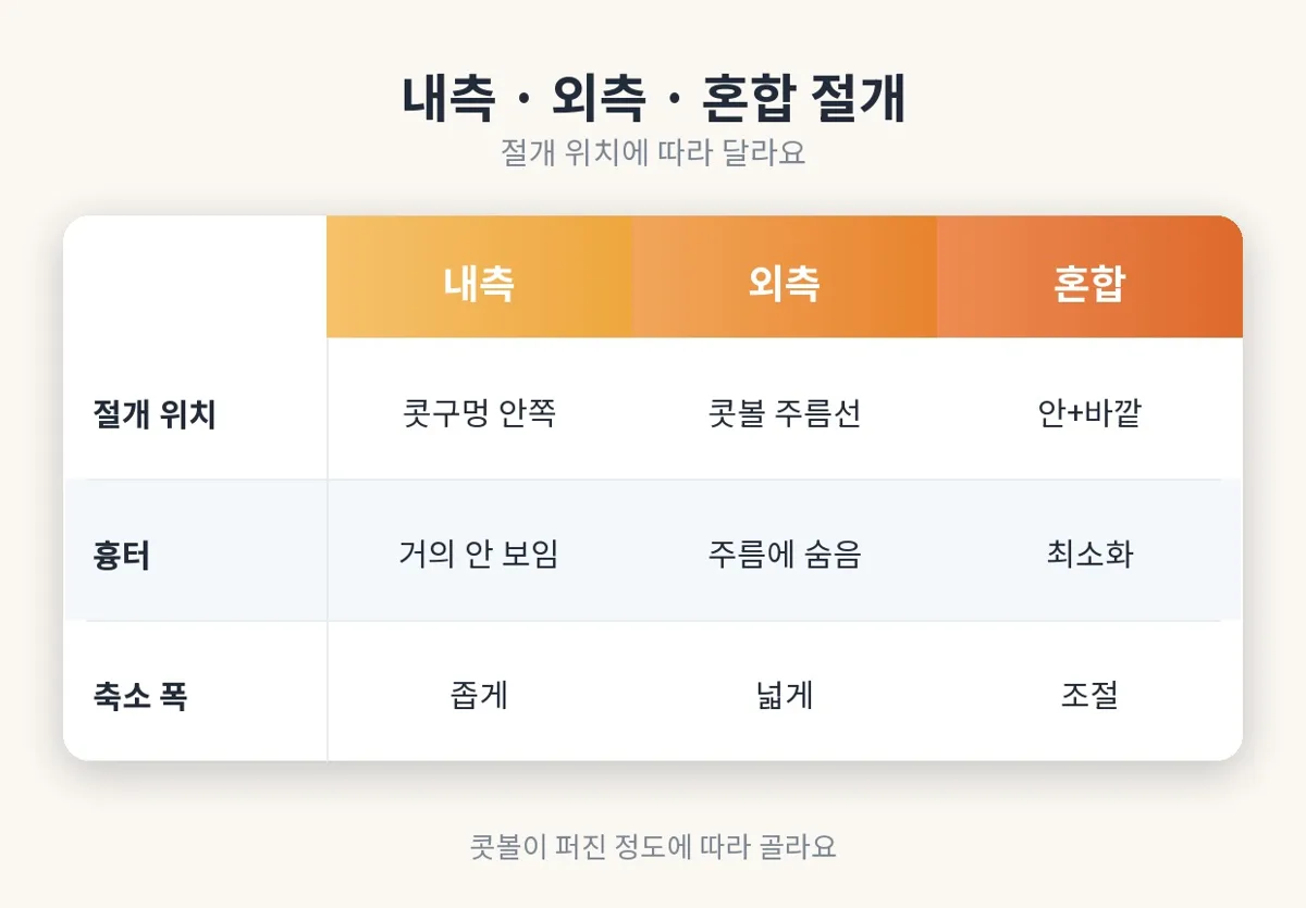 콧볼축소 관련 이미지