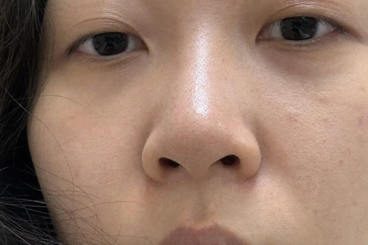 콧볼축소 관련 이미지