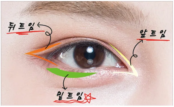 트임수술 관련 이미지