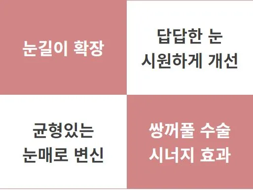 트임수술 관련 이미지