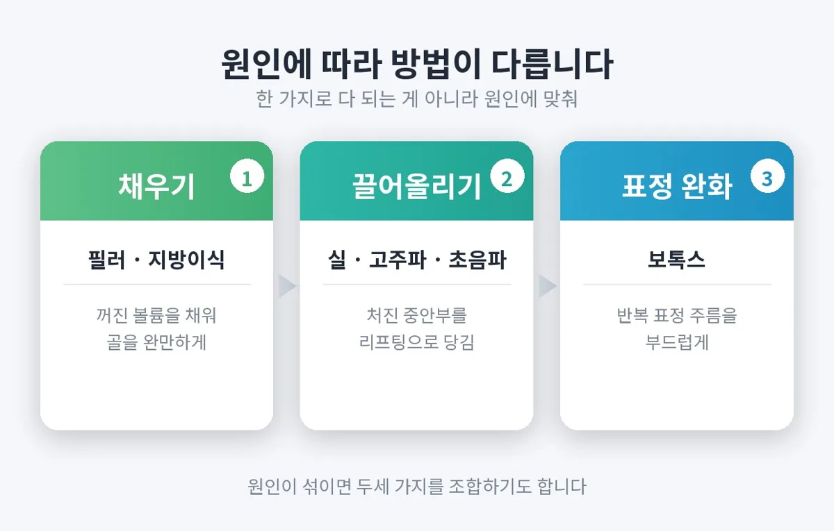 팔자주름 관련 이미지