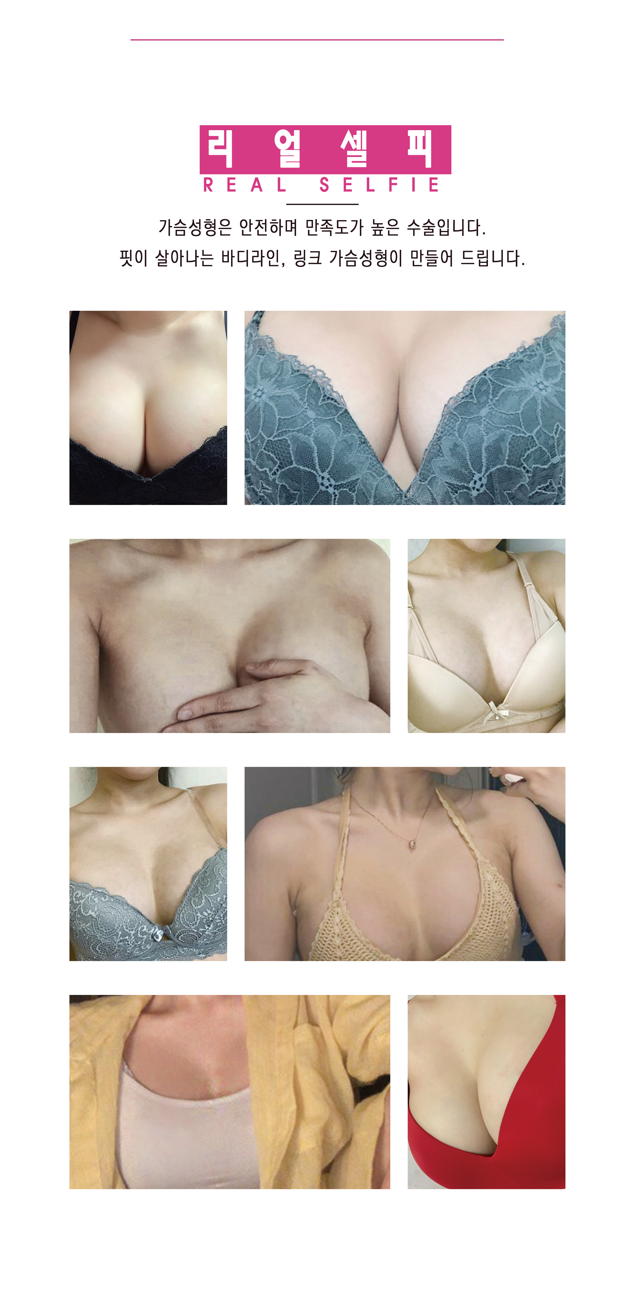 가슴성형_링크성형외과_리얼셀피_성하민원장_정민수원장