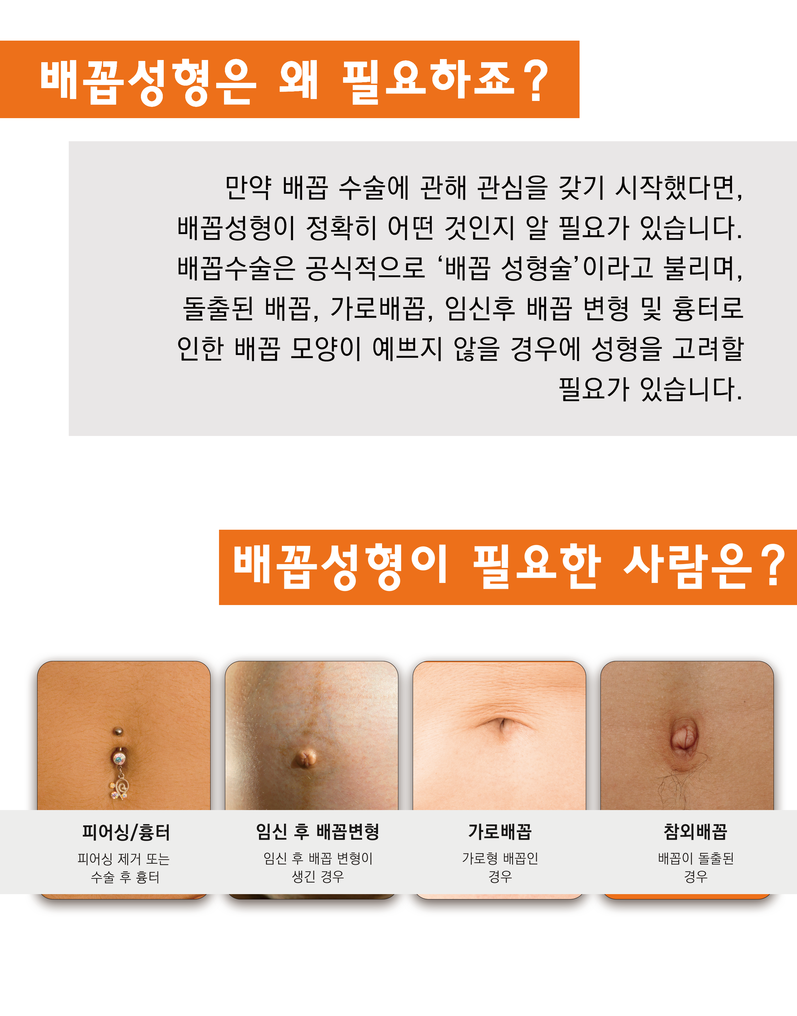 배꼽성형_링크성형외과_성하민원장_상단