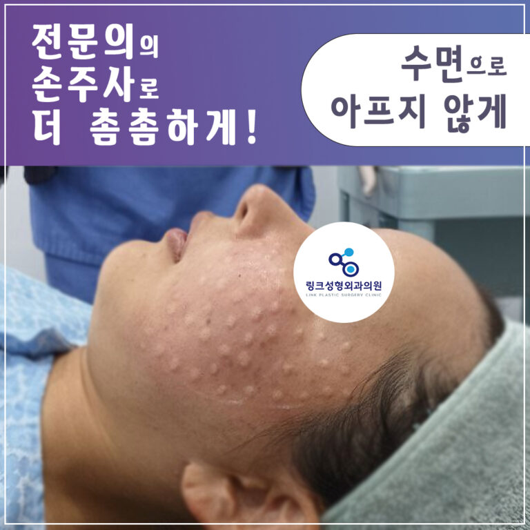 리쥬란_리쥬란힐러_수면리쥬란_리쥬란효과_리쥬란비용_5_리쥬란 실제 후기