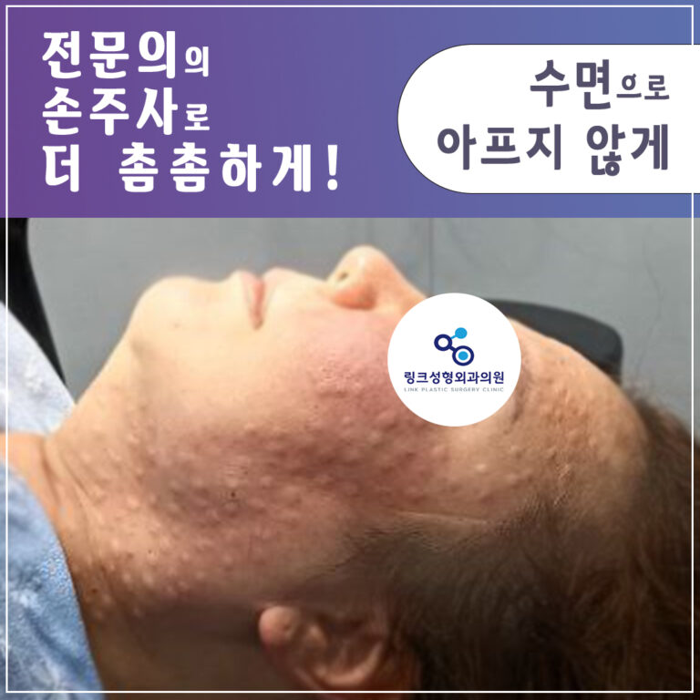 리쥬란_리쥬란힐러_수면리쥬란_리쥬란효과_리쥬란비용_6_리쥬란 실제 후기