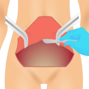 전체복부성형_링크성형외과_성하민원장_정민수원장_2