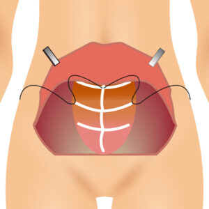 전체복부성형_링크성형외과_성하민원장_정민수원장_3